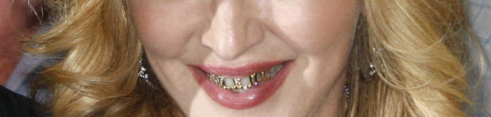Madonna forra dentes... a ouro e diamantes