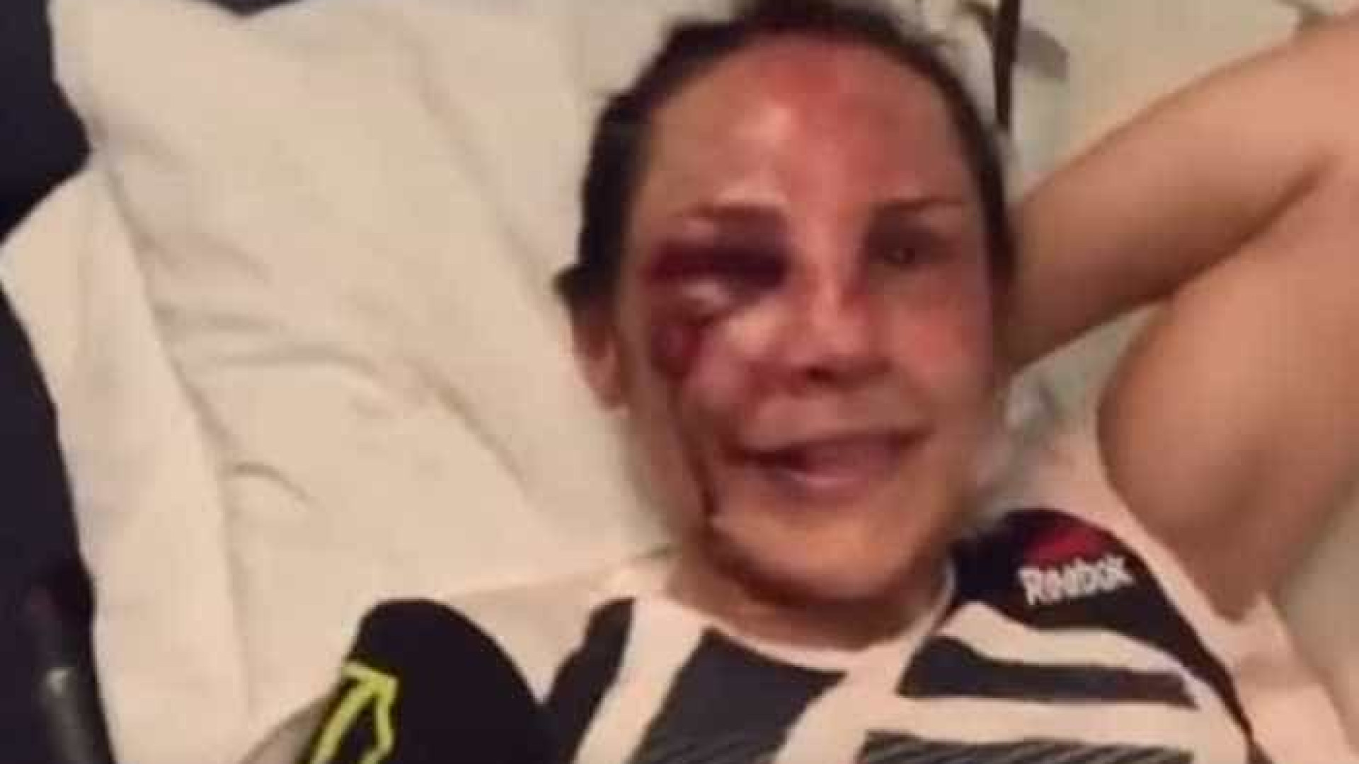 Lutadora de UFC ficou neste estado e teve de ser levada para o hospital