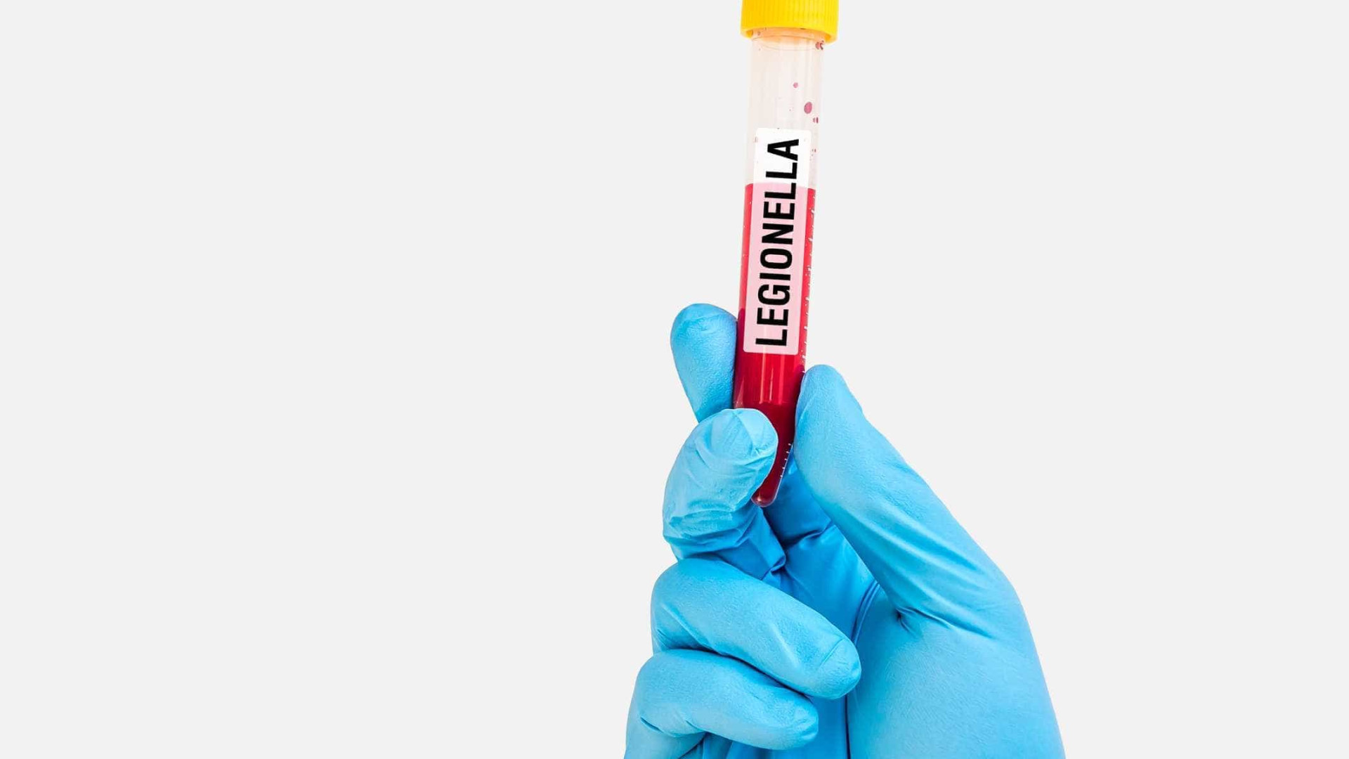 Legionella: Sobe para 15 número de casos de surto na CUF Descobertas