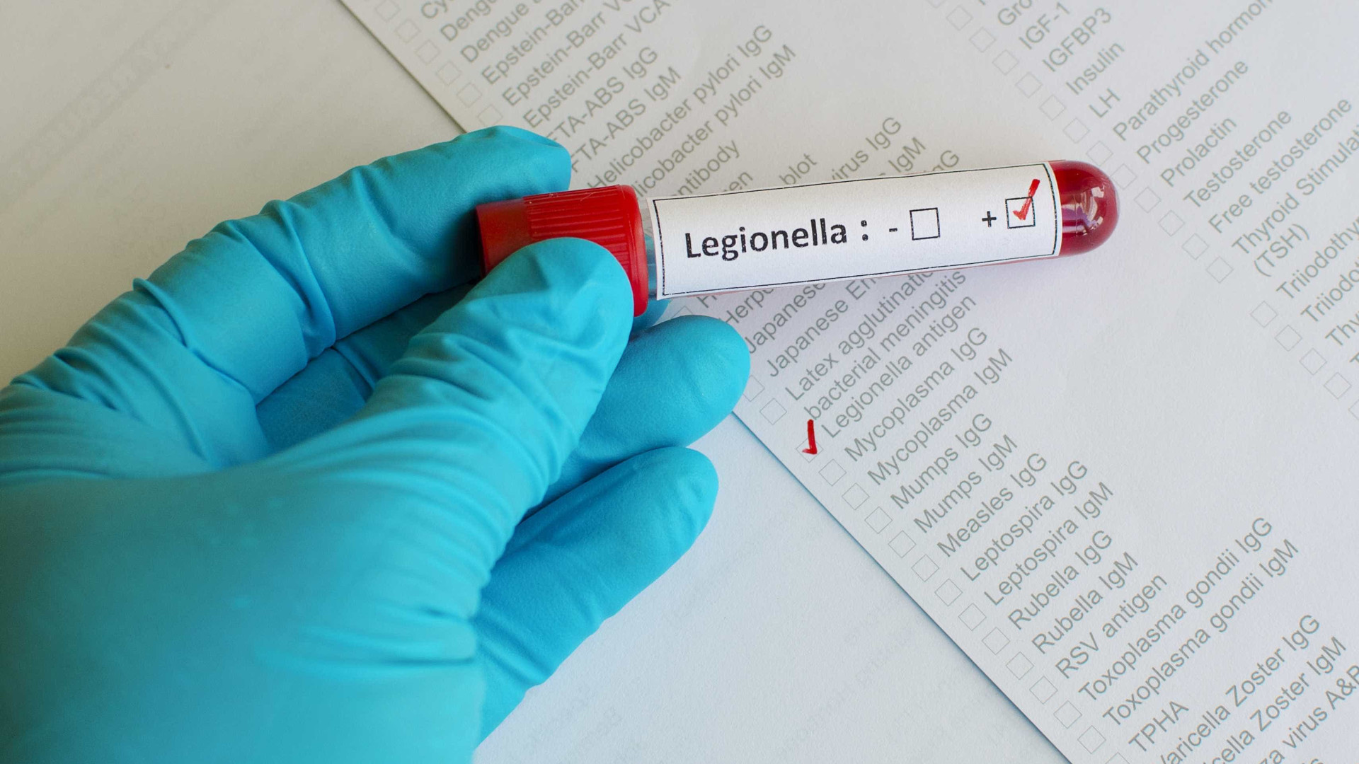 Legionella: Tudo o que foi revelado (ou não) na audição sobre o surto