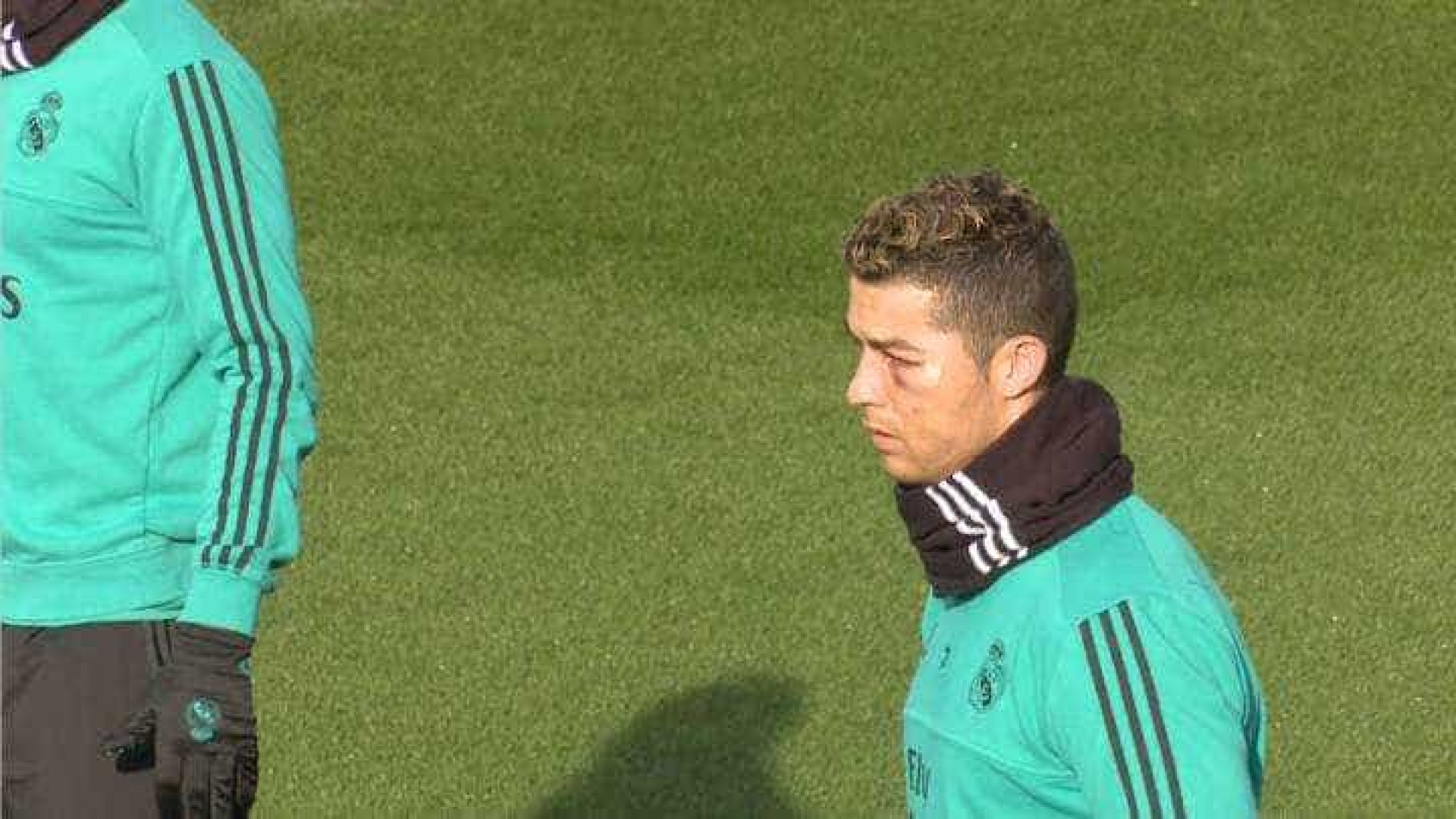 Ronaldo já treinou sem limitações mas... com o olho negro