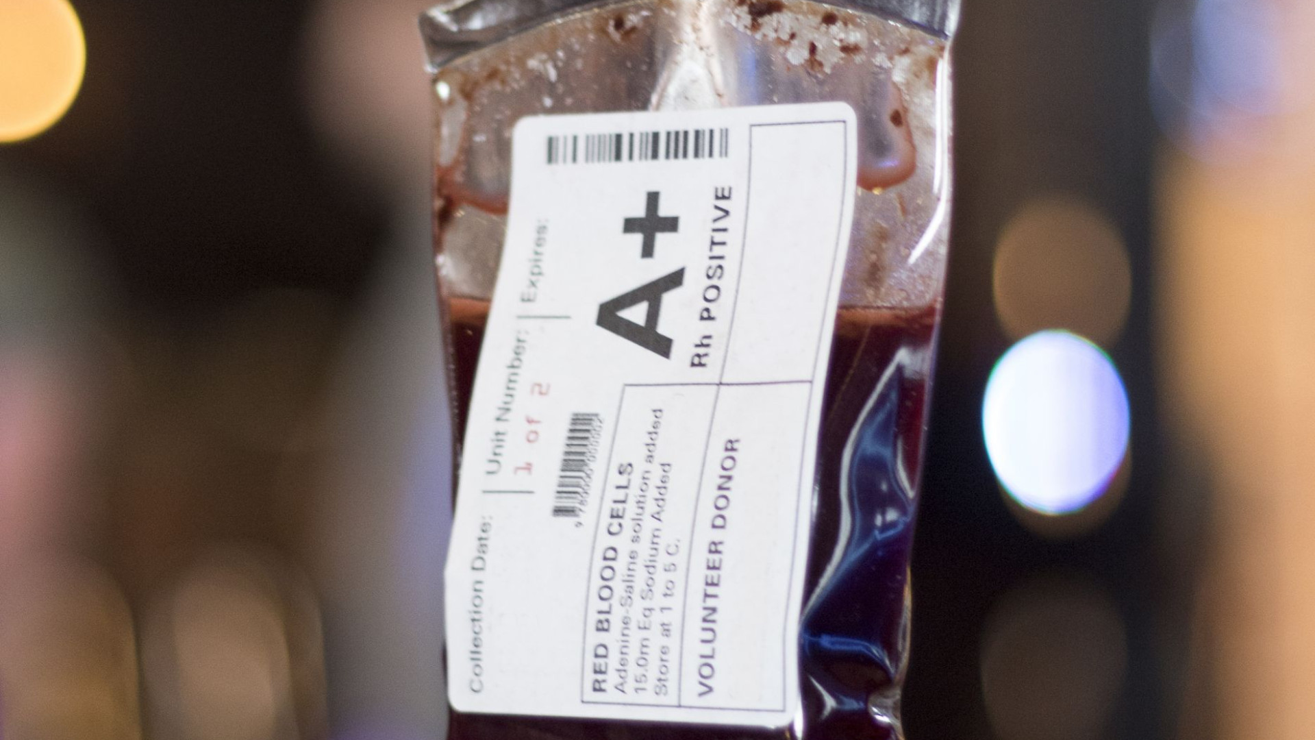 Recebeu transfusão de sangue com hepatite C. Foi avisada seis anos depois