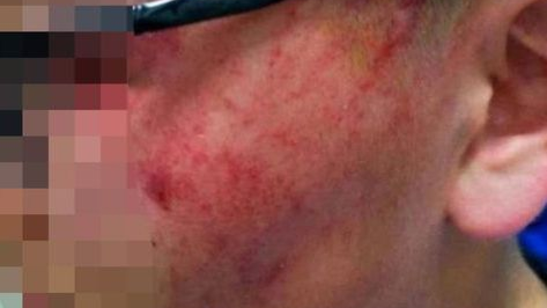 Professora deixa aluno com ferimentos graves após dar-lhe 12 bofetadas