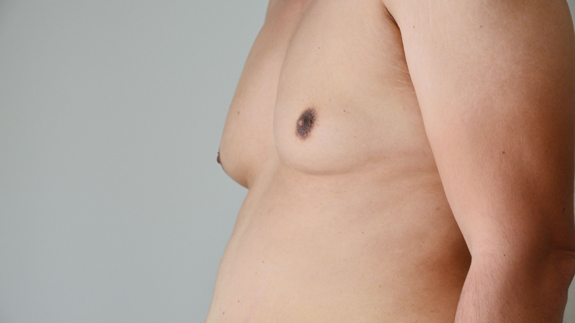 Homens. Cinco métodos fáceis para dizer adeus às 'man boobs'