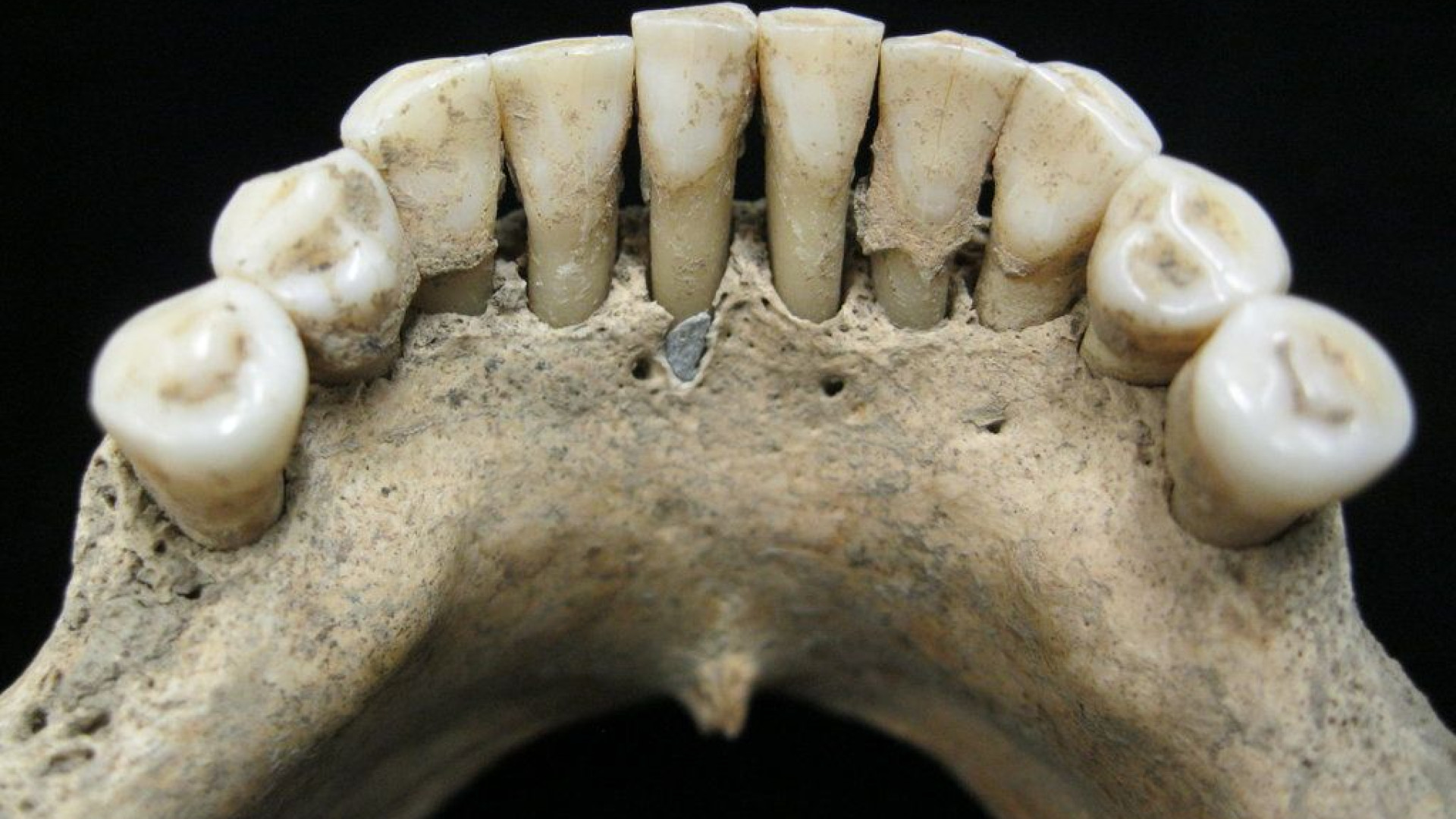 Porque é que esta mulher medieval tinha lápis-lazúli nos dentes?