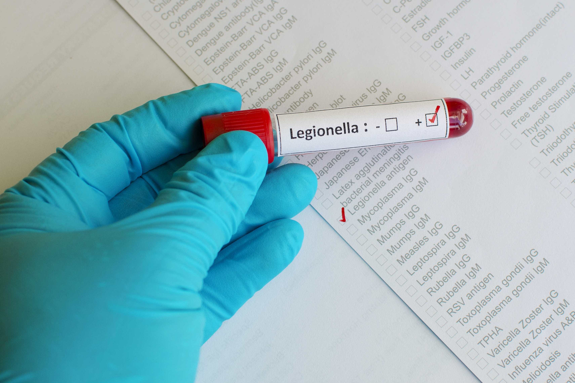 Legionella: Uma semana, quatro mortos e muita polémica