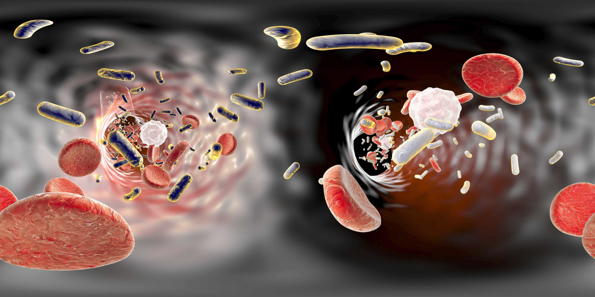 Legionella: Uma semana, quatro mortos e muita polémica