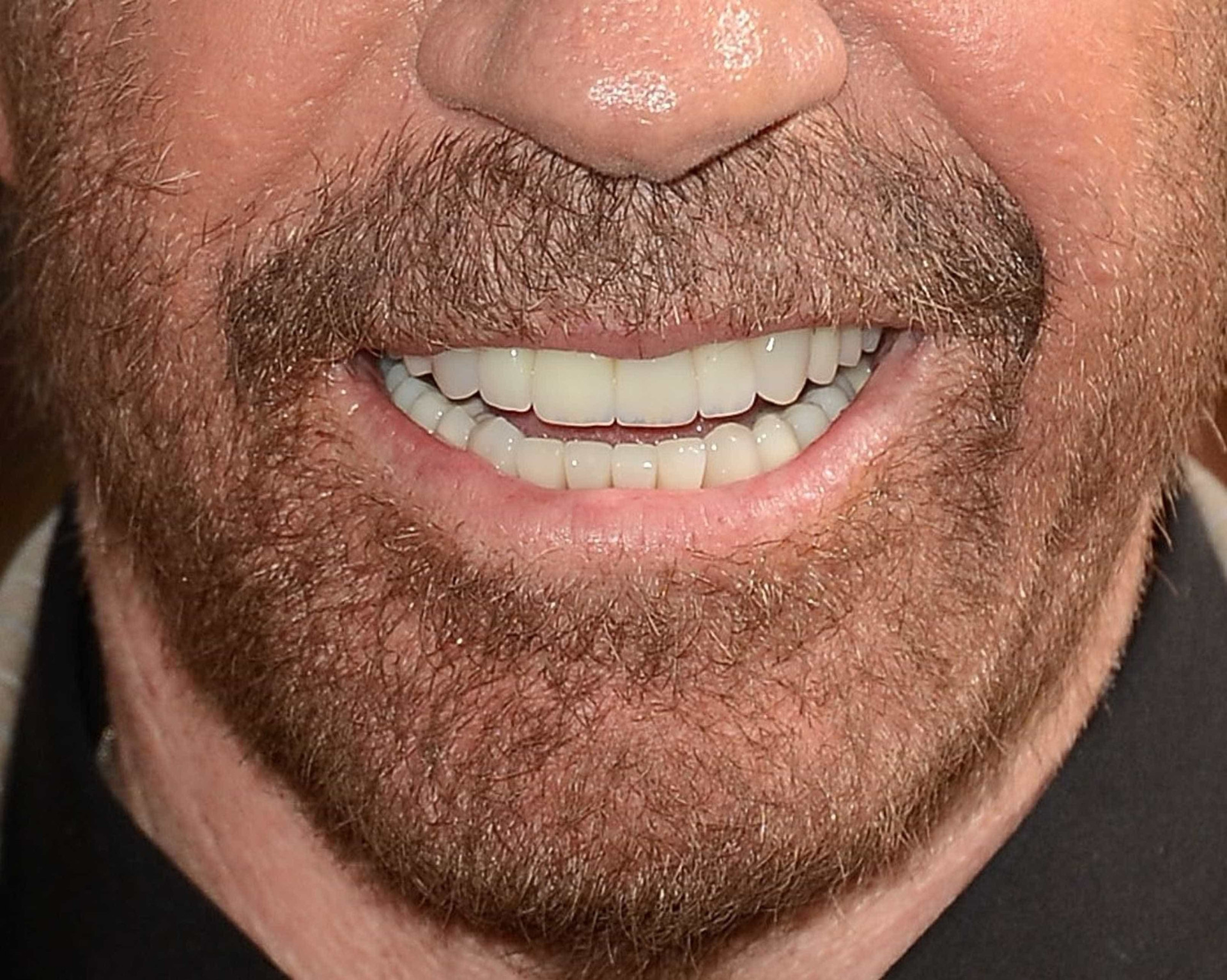 Consegue descobrir quem são estas celebridades vendo apenas a barba?