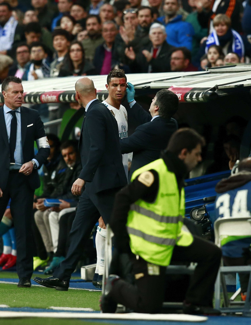 Ronaldo sangrou e foi buscar um... telemóvel