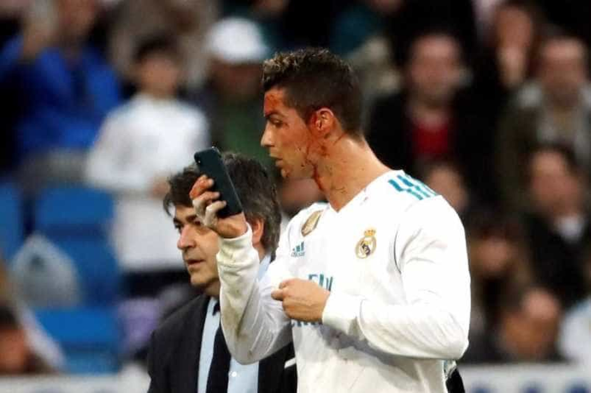 Ronaldo sangrou e foi buscar um... telemóvel