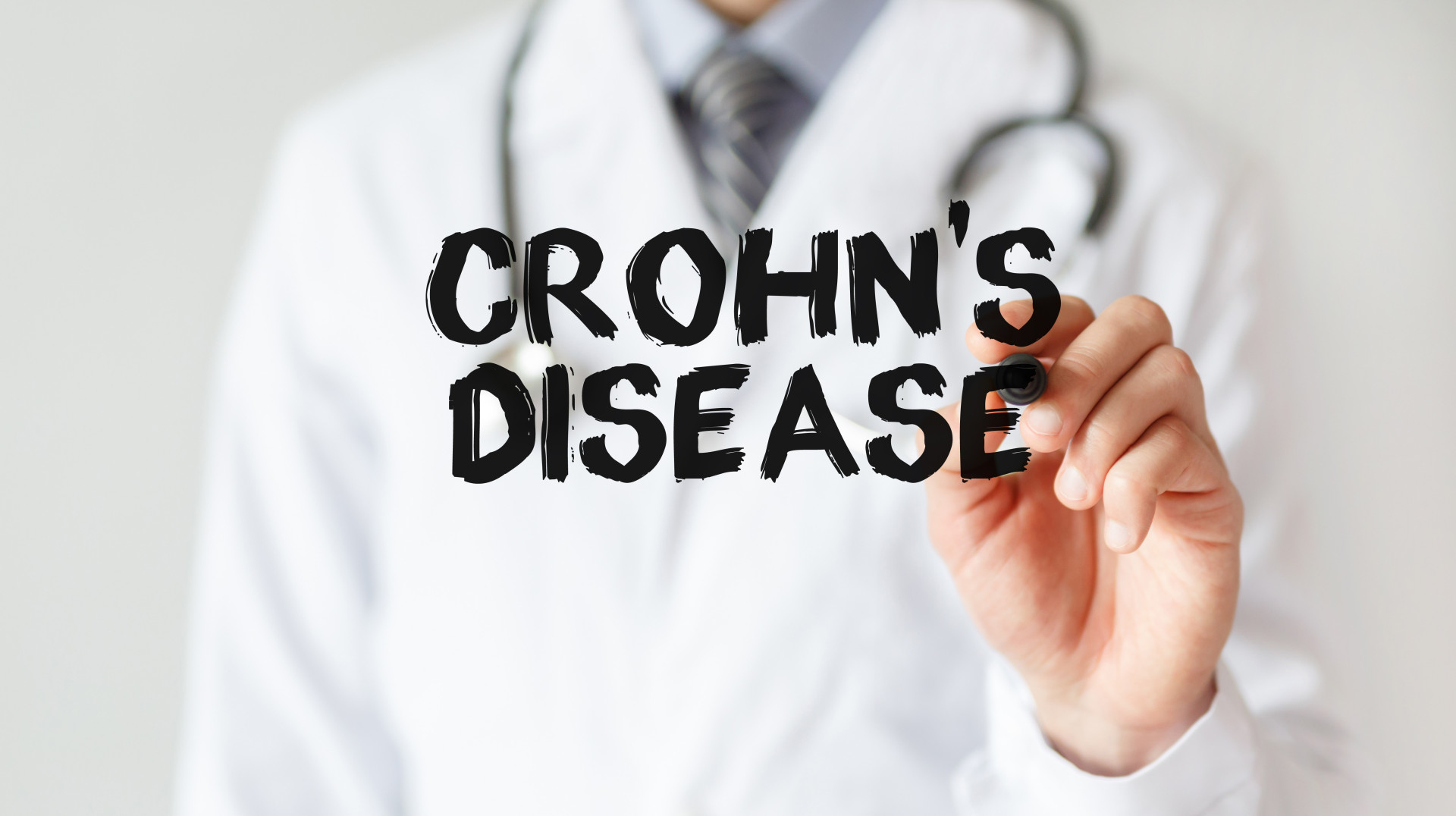 Saiba o que é a doença de Crohn e evite um futuro diagnóstico