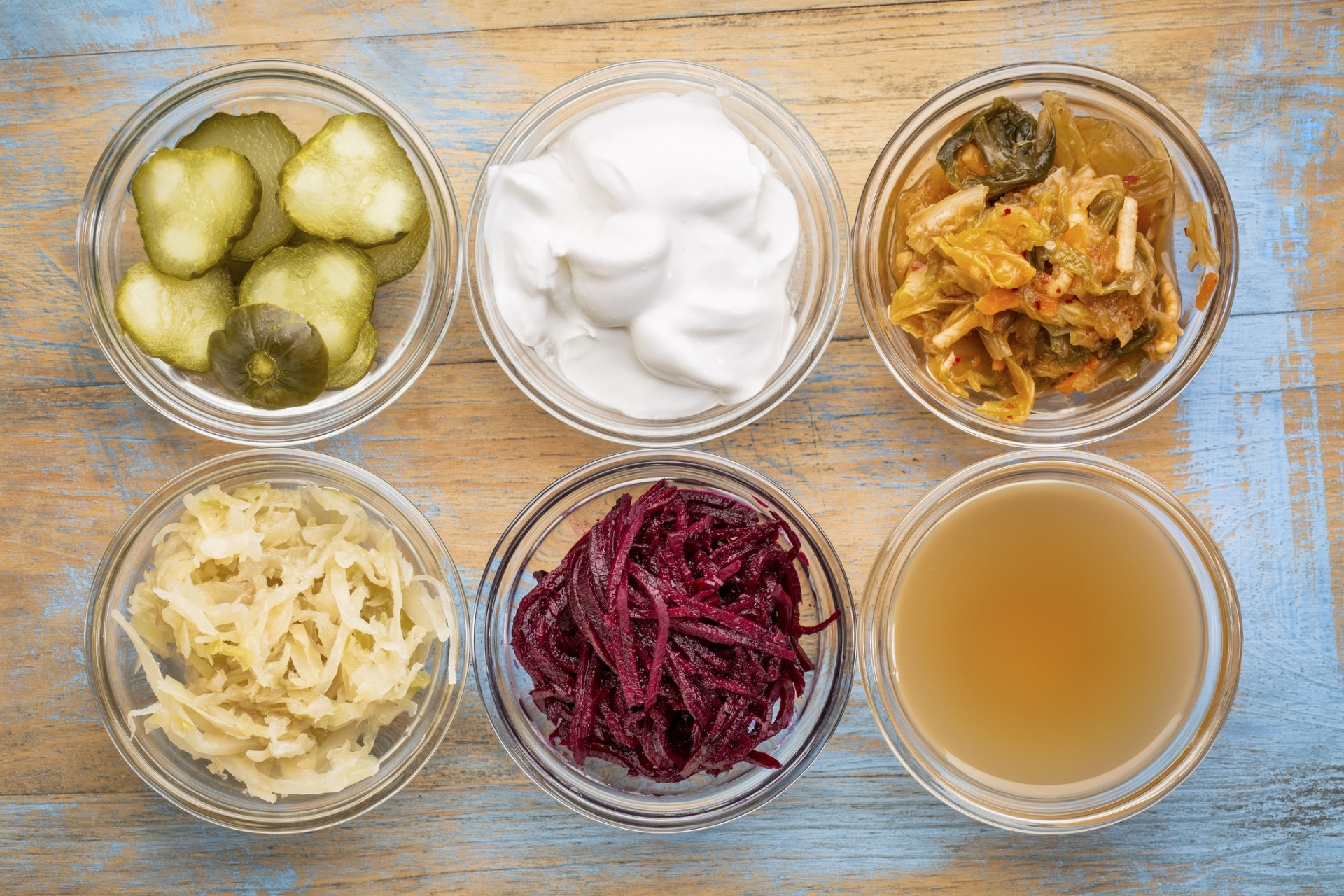Conheça os alimentos probióticos que mantém o seu organismo saudável