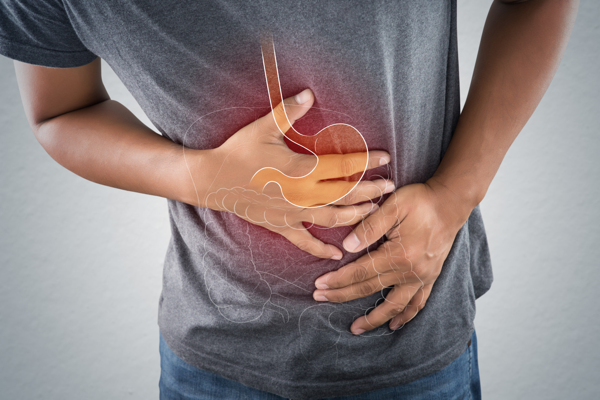 Saiba o que é a doença de Crohn e evite um futuro diagnóstico